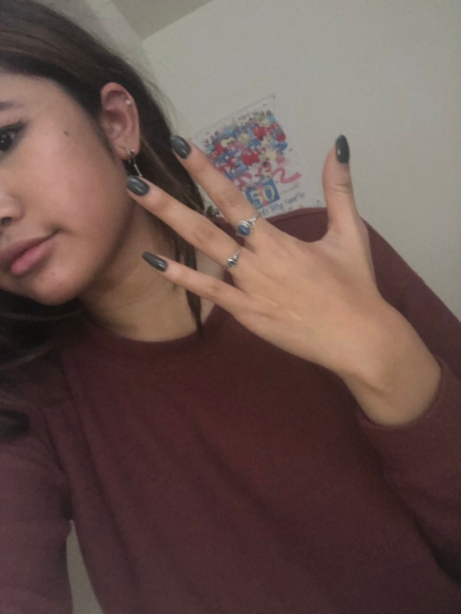 This Girl Has Four Fingers On One Of Her Hands 4 Pics