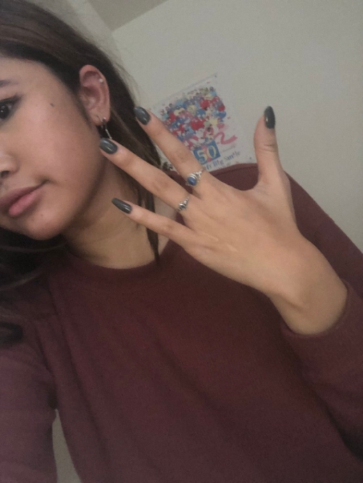 This Girl Has Four Fingers On One Of Her Hands (4 pics)