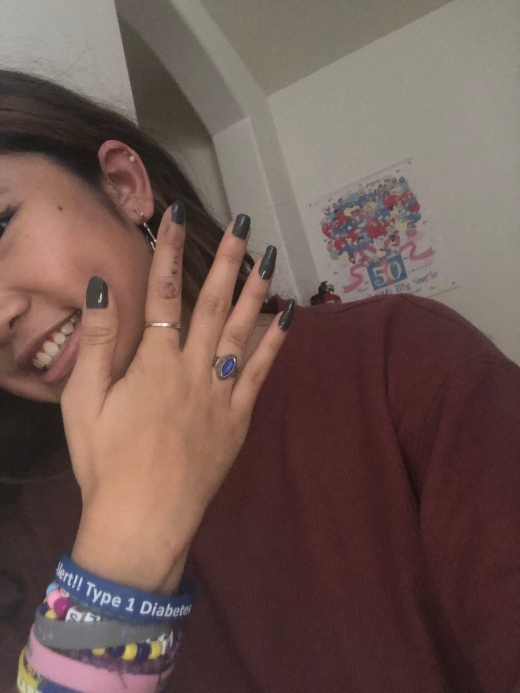 This Girl Has Four Fingers On One Of Her Hands (4 pics)