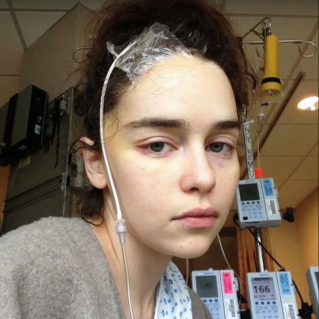 Emilia Clarke Shares Photos From Hospital Treatment During Brain Aneurysm Ordeal (4 pics)