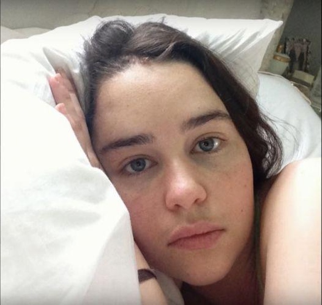 Emilia Clarke Shares Photos From Hospital Treatment During Brain Aneurysm Ordeal (4 pics)