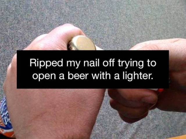 People Always Find Ways To Injure Themselves (20 pics)