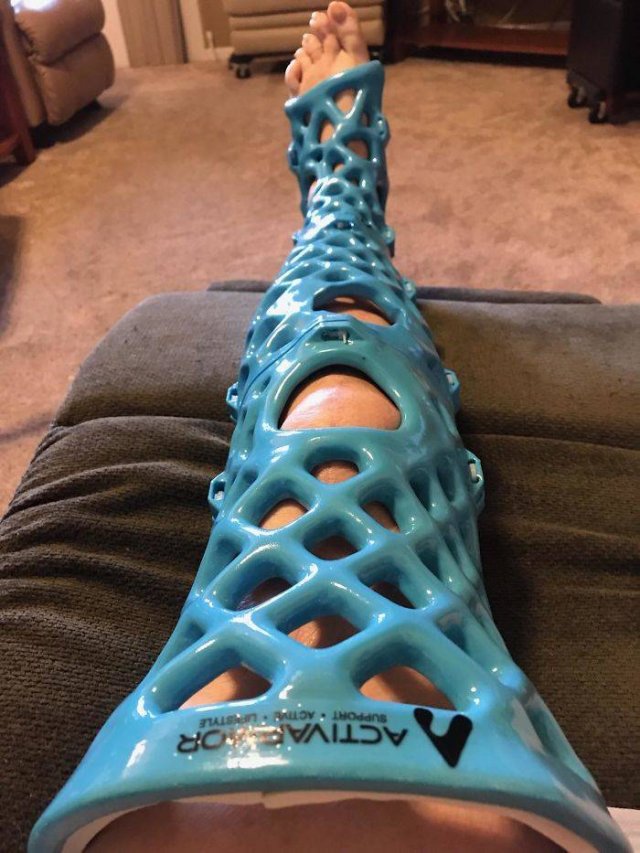 3d printing examples creative printed plastic broken cast bones