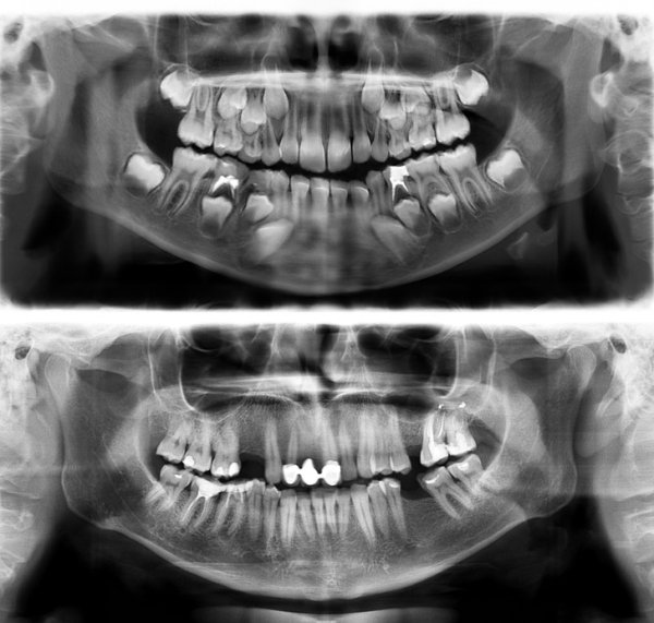 Interesting X-Rays And Scans (22 pics)