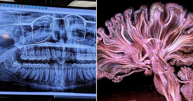 Interesting X-Rays And Scans (22 pics)