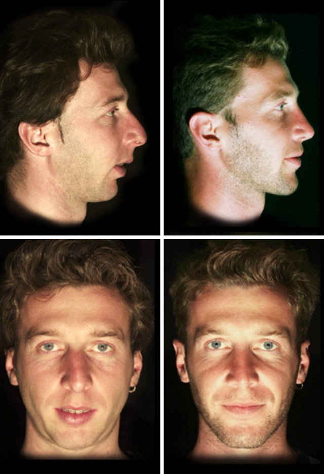 People Who Have Changed Themselves Drastically (13 pics)