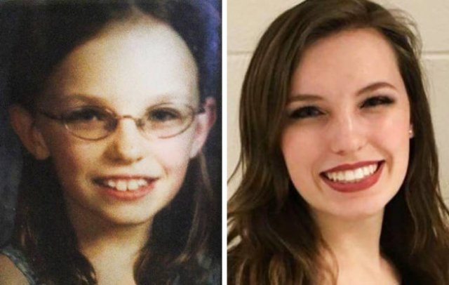 People Who Have Changed Themselves Drastically (13 pics)