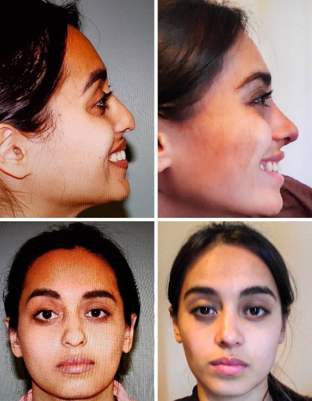People Who Have Changed Themselves Drastically (13 pics)