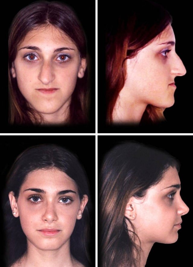 People Who Have Changed Themselves Drastically (13 pics)