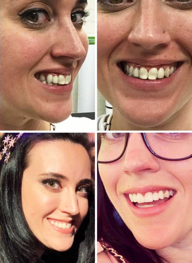 People Who Have Changed Themselves Drastically (13 pics)