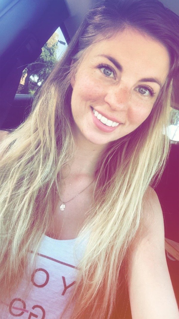 Girls With Freckles (32 pics)