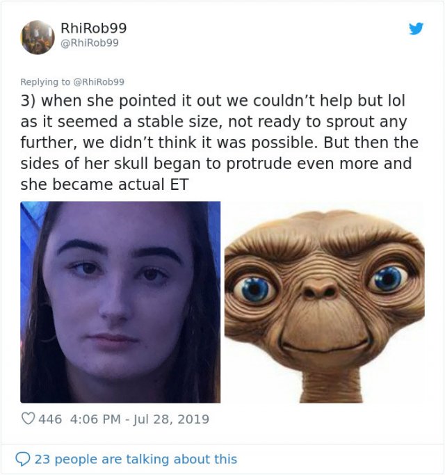 Girl Starts To Look Like An Alien Due To Random Head Swelling (14 pics)