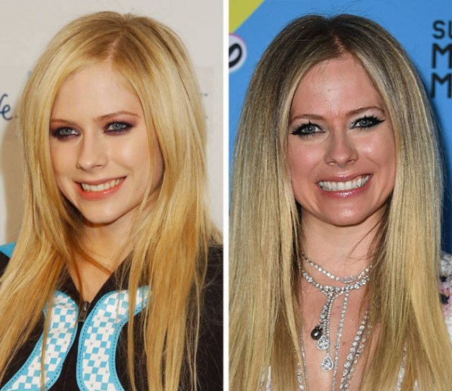 Famous Music Artists Then And Now (20 pics)