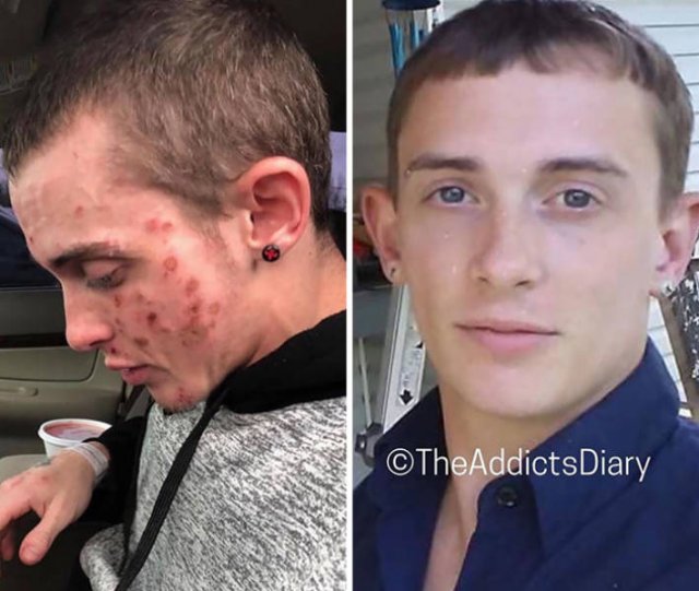 During And After Drug Addiction(40 pics)