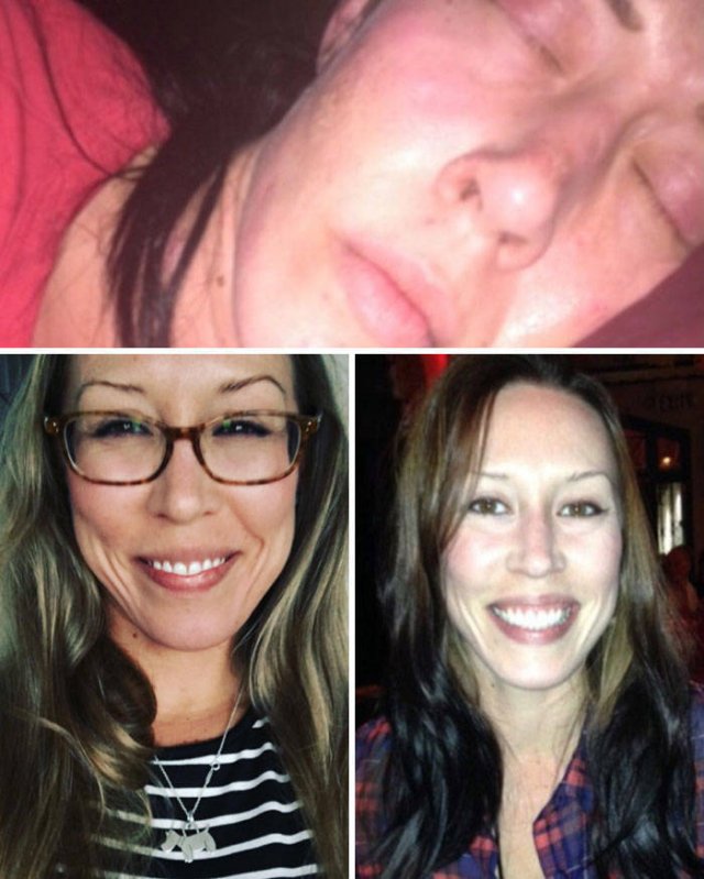 During And After Drug Addiction(40 pics)