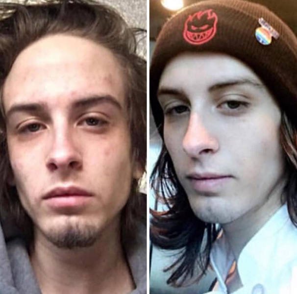 During And After Drug Addiction(40 pics)