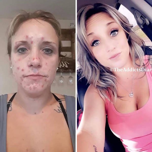 During And After Drug Addiction(40 pics)