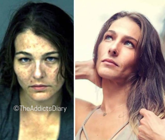 During And After Drug Addiction(40 pics)