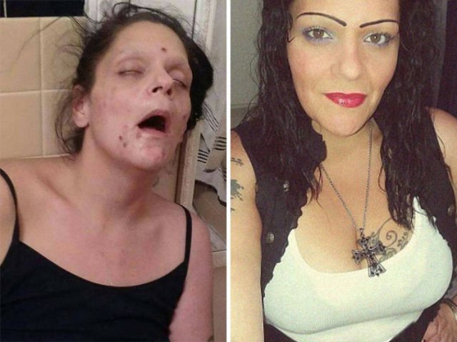 During And After Drug Addiction(40 pics)