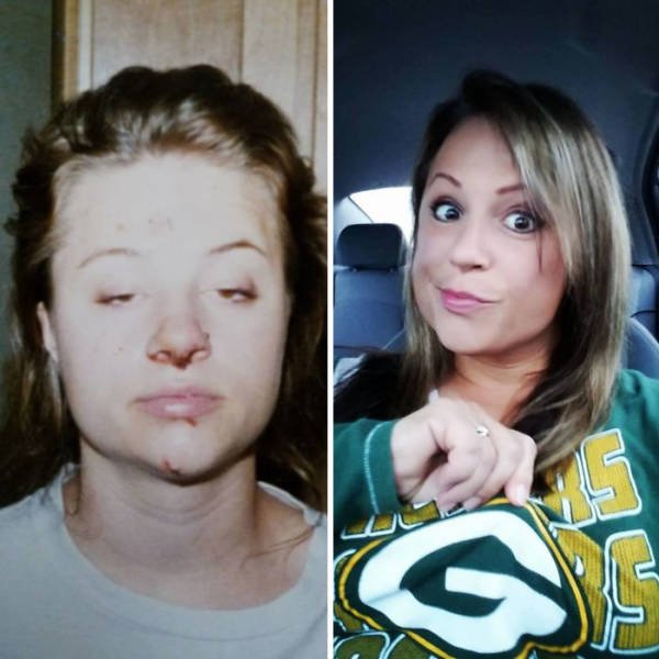 During And After Drug Addiction(40 pics)