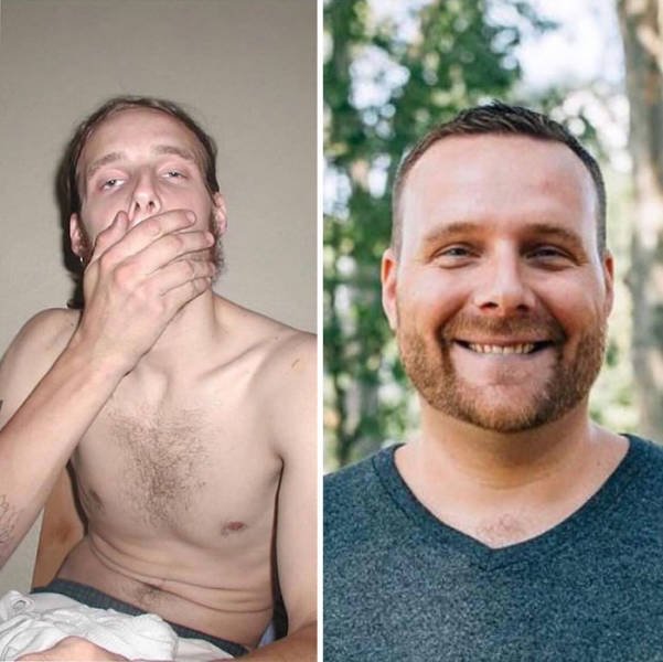 During And After Drug Addiction(40 pics)