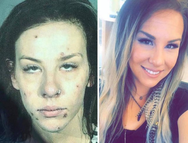 During And After Drug Addiction(40 pics)