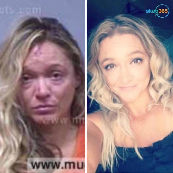 During And After Drug Addiction(40 pics)