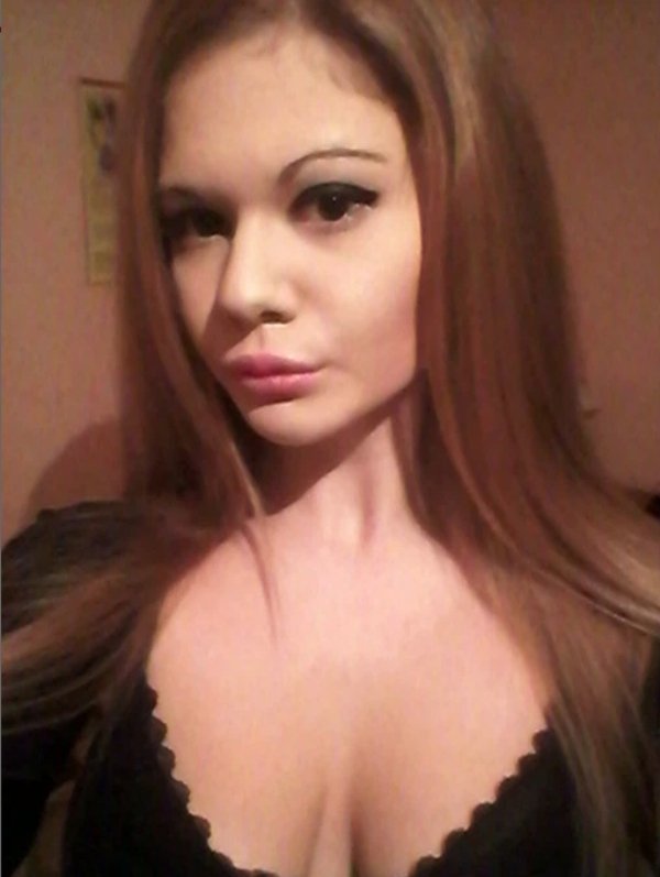 Andrea Emilova Ivanova Has Tripled The Size Of Her Lips (7 pics)