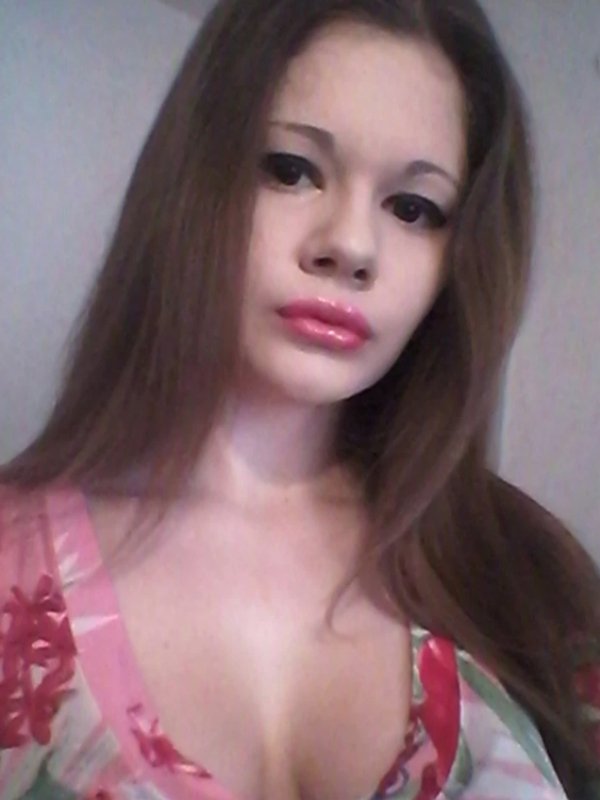 Andrea Emilova Ivanova Has Tripled The Size Of Her Lips (7 ...