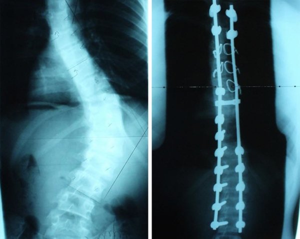 Before & After (27 pics)