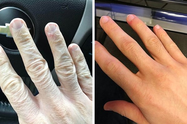 Before & After (27 pics)