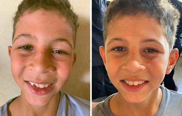 Brazilian Dentist Travels To Treat The Teeth Of Poor People For Free (30 pics)