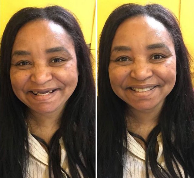 Brazilian Dentist Travels To Treat The Teeth Of Poor People For Free (30 pics)