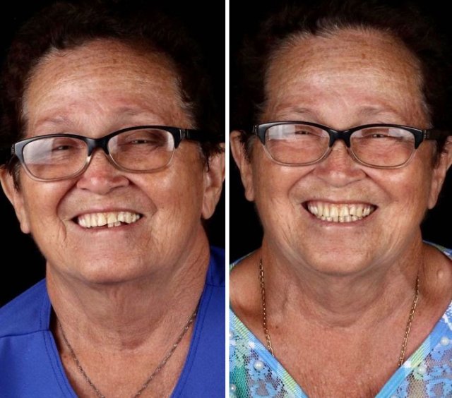 Brazilian Dentist Travels To Treat The Teeth Of Poor People For Free (30 pics)