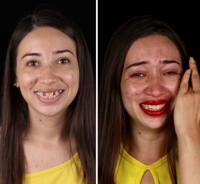Brazilian Dentist Travels To Treat The Teeth Of Poor People For Free (30 pics)