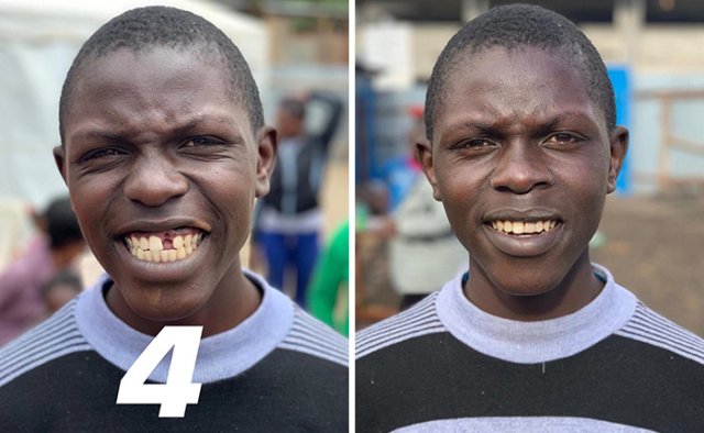 Brazilian Dentist Travels To Treat The Teeth Of Poor People For Free (30 pics)