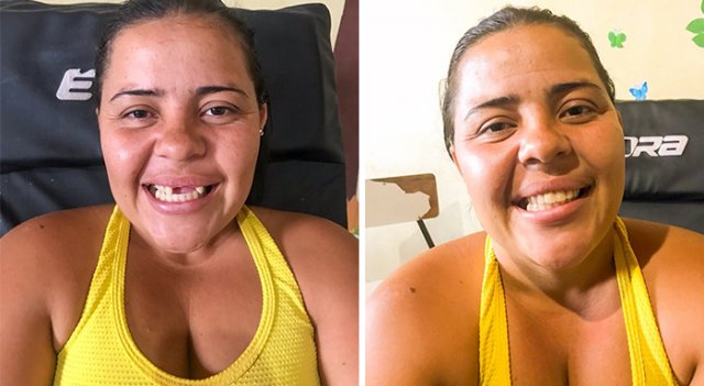 Brazilian Dentist Travels To Treat The Teeth Of Poor People For Free (30 pics)