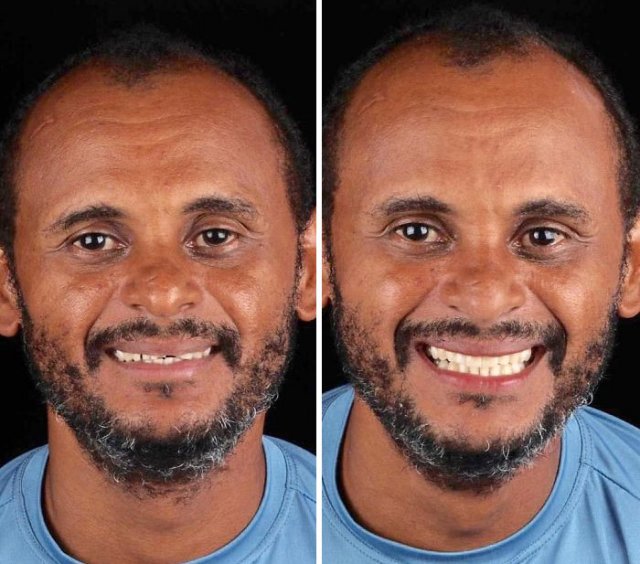 Brazilian Dentist Travels To Treat The Teeth Of Poor People For Free (30 pics)