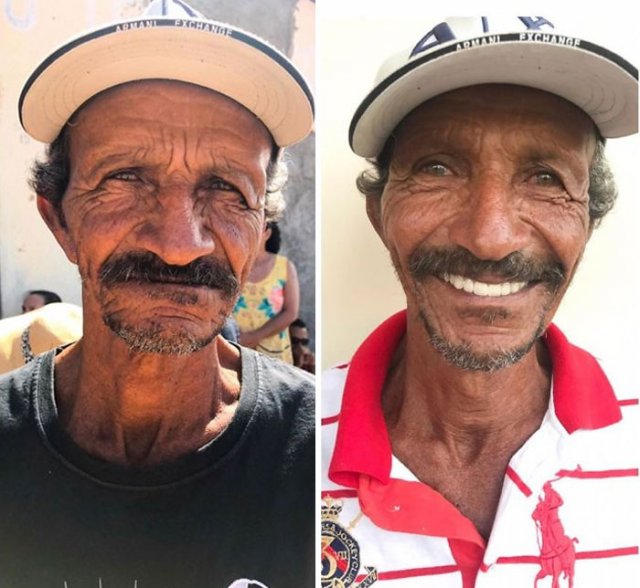 Brazilian Dentist Travels To Treat The Teeth Of Poor People For Free (30 pics)
