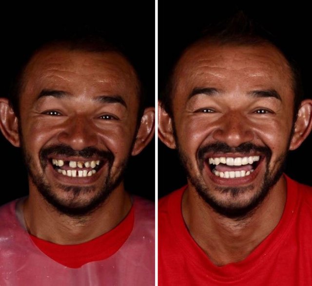Brazilian Dentist Travels To Treat The Teeth Of Poor People For Free (30 pics)