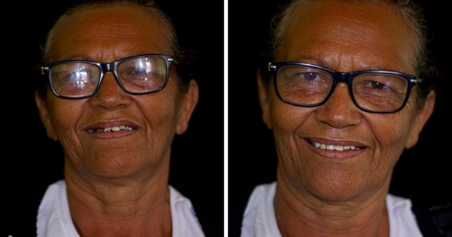 Brazilian Dentist Travels To Treat The Teeth Of Poor People For Free (30 pics)