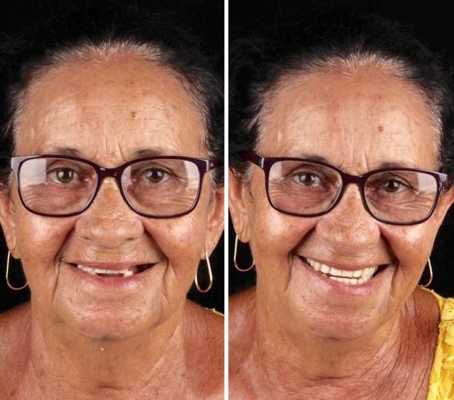 Brazilian Dentist Travels To Treat The Teeth Of Poor People For Free (30 pics)