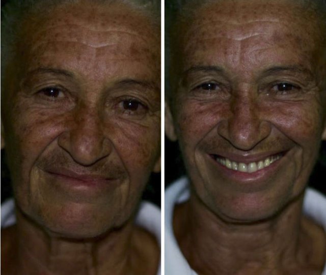 Brazilian Dentist Travels To Treat The Teeth Of Poor People For Free (30 pics)