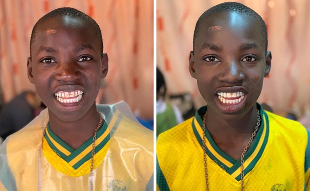 Brazilian Dentist Travels To Treat The Teeth Of Poor People For Free (30 pics)