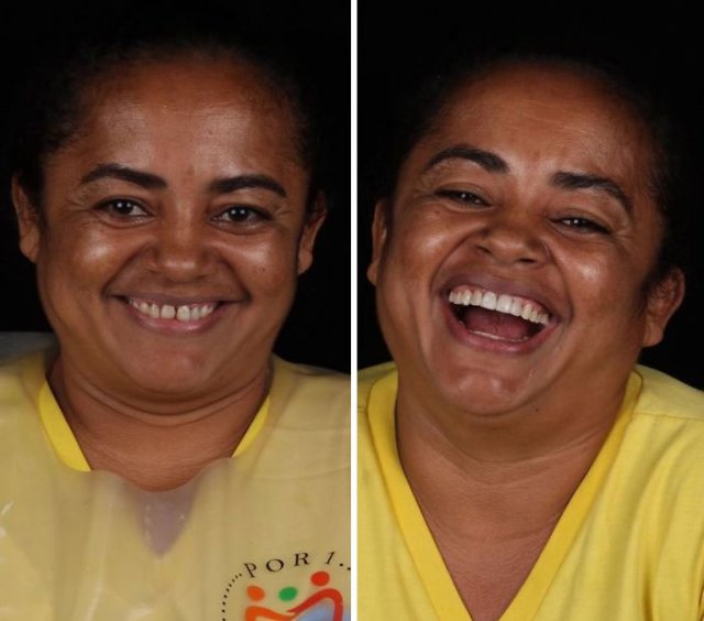 Brazilian Dentist Travels To Treat The Teeth Of Poor People For Free (30 pics)
