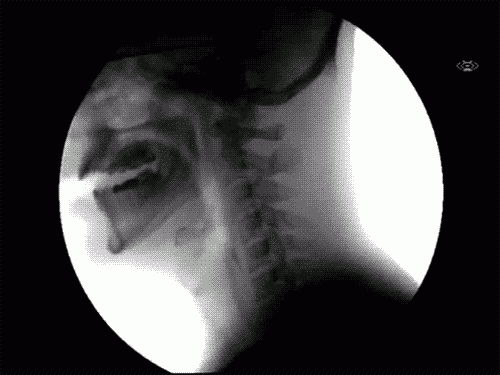 Informative Gifs (17 gifs) Informative Gifs (17 gifs)