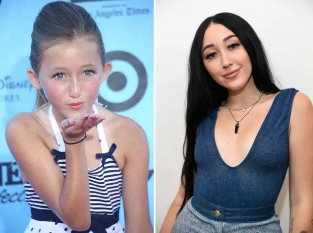 Celebs Then And Now (31 pics) Celebs Then And Now (31 pics)
