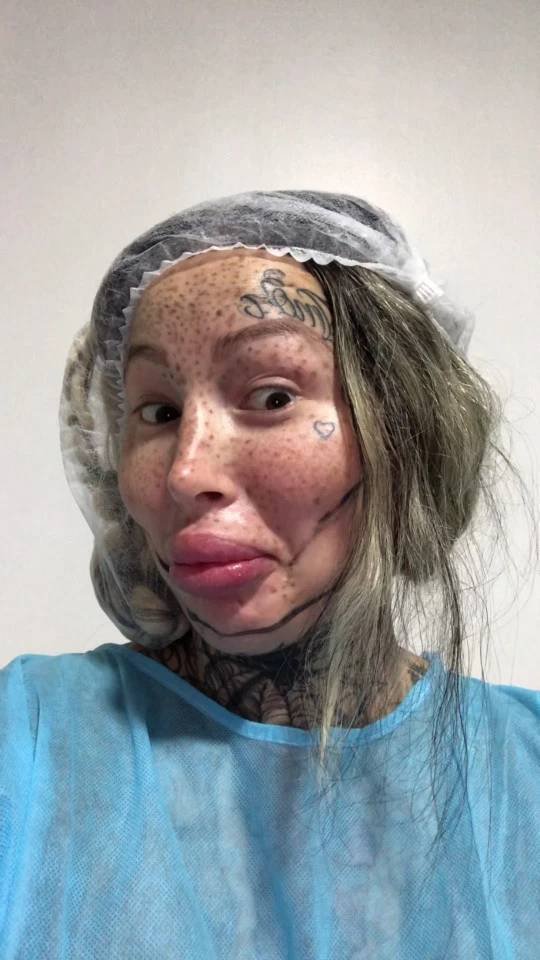 $100K Worth Of Plastic Surgeries. Was It Worth it? (9 pics)