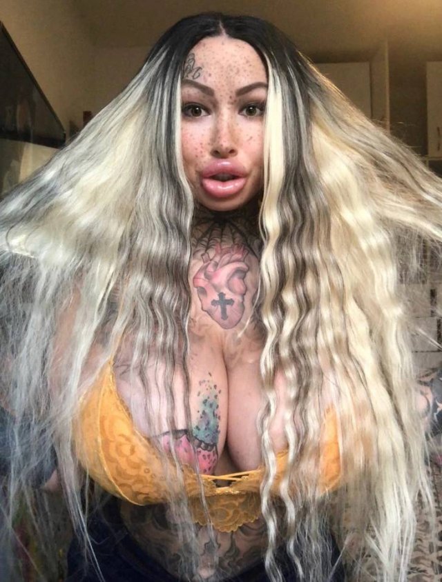 $100K Worth Of Plastic Surgeries. Was It Worth it? (9 pics)