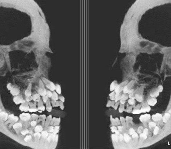 Horror Will Find You (23 pics)